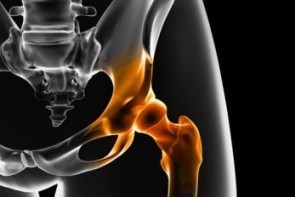 oliki arthroplastiki isxiou orthoprothesis adam athanasios